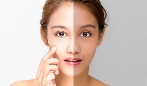 Face Whitening