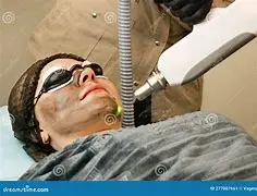 Carbon Peeling Face & Neck 