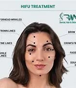 Hifu Face & Eyes 