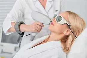 Hair Removal Upper Lips 