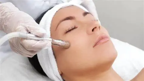 Microdermabrasion 