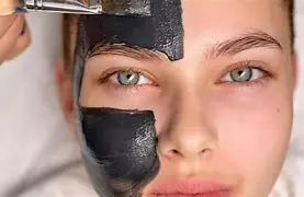 Carbon Peeling Face