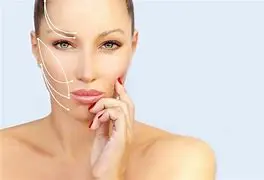 Facelift 