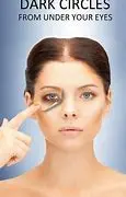 Dark Circles 